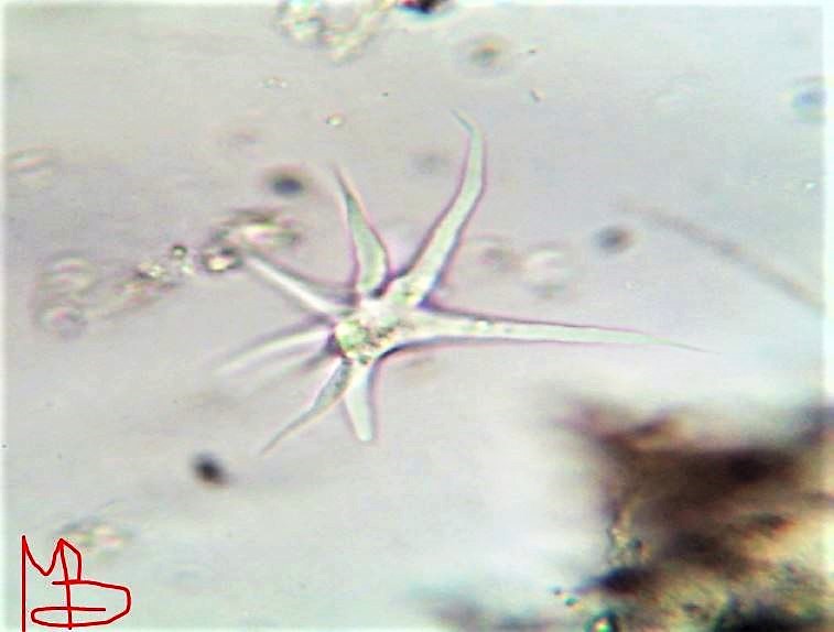 Amoeba stellata metamorfosi